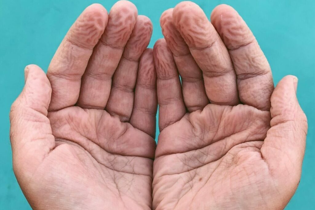 Schrumpelige Finger und Füße: Der Grund für runzelige Haut im Wasser